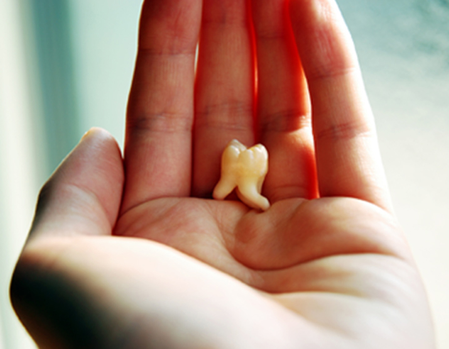 文京区親知らずとは